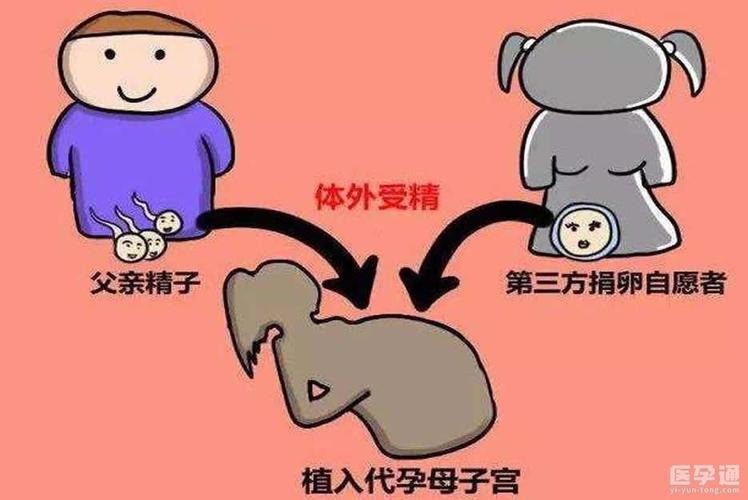 试管供卵代怀